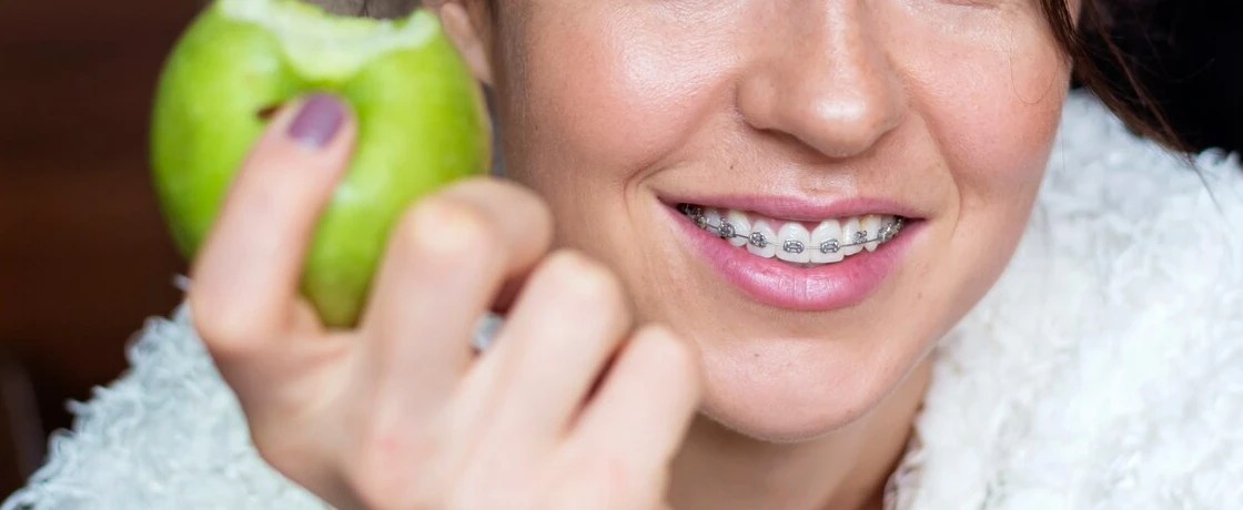 Ortodontik tedavi sırasında beslenme önerileri