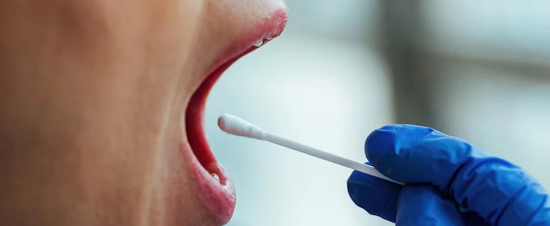 Ağız Yaraları ve Tedavi Yöntemleri