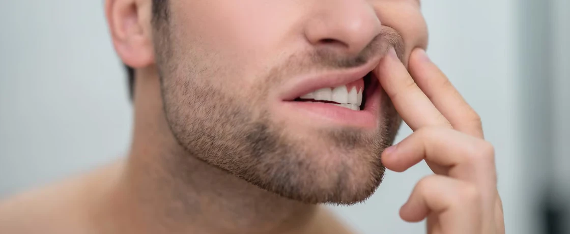 Diş Eti İltihabı Nedir? Nasıl Önlenir?