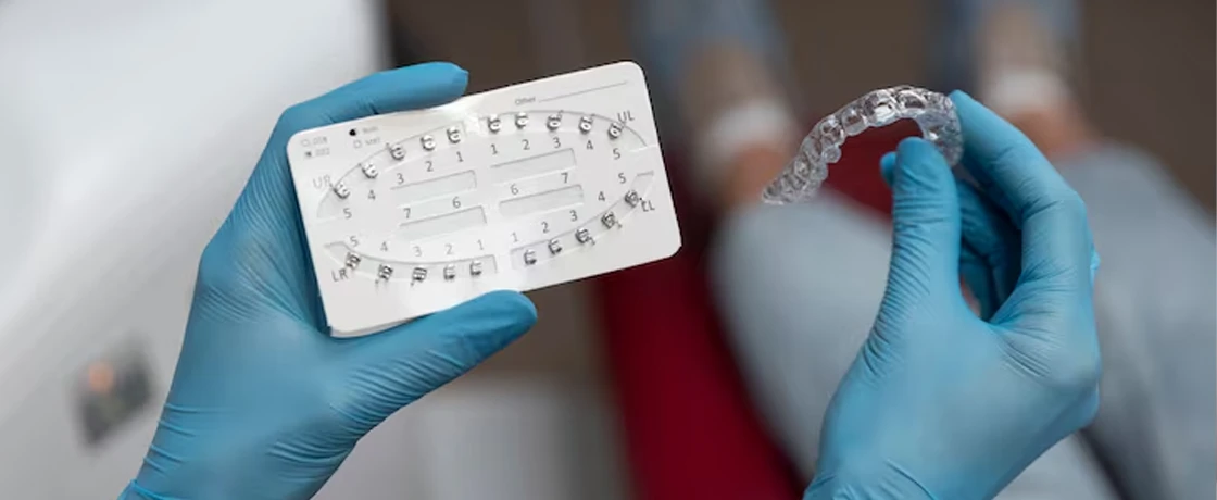 Şeffaf Plaklar ile Diş Düzeltme